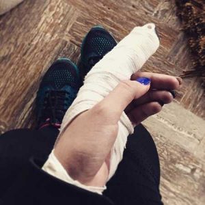 انگشت پریناز ایزدیار در گچ