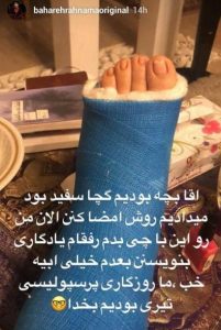 پای بهاره رهنما در گچ