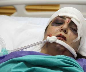 باران کوثری با صورتی کبود روی تخت بیمارستان 