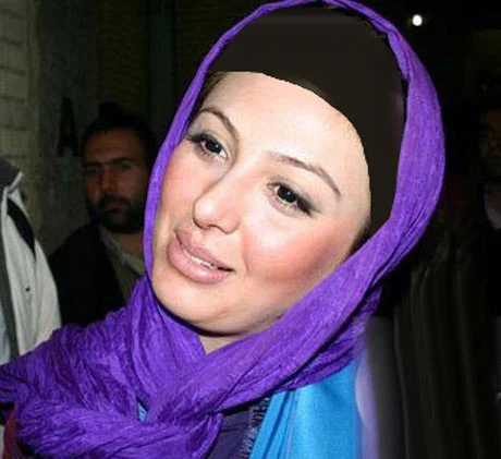 عمل زیبایی نیوشا ضیغمی