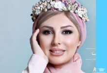عمل زیبایی نیوشا ضیغمی