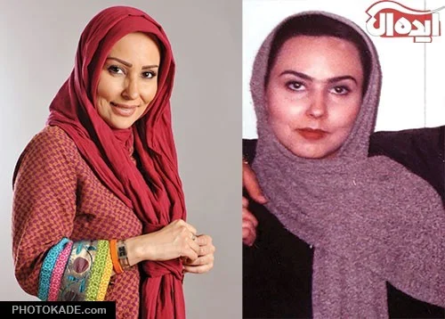 پرستو صالحی قبل با شال بنفش و پرستو صالحی با شال قرمز -عمل زیبایی پرستو صالحی