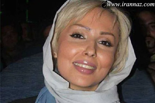 پرستو صالحی با موی بلوند و شال سفید - عمل زیبایی پرستو صالحی