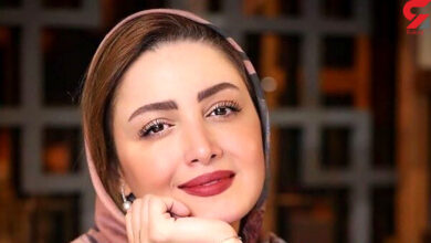 عمل زیبایی شیلا خداداد
