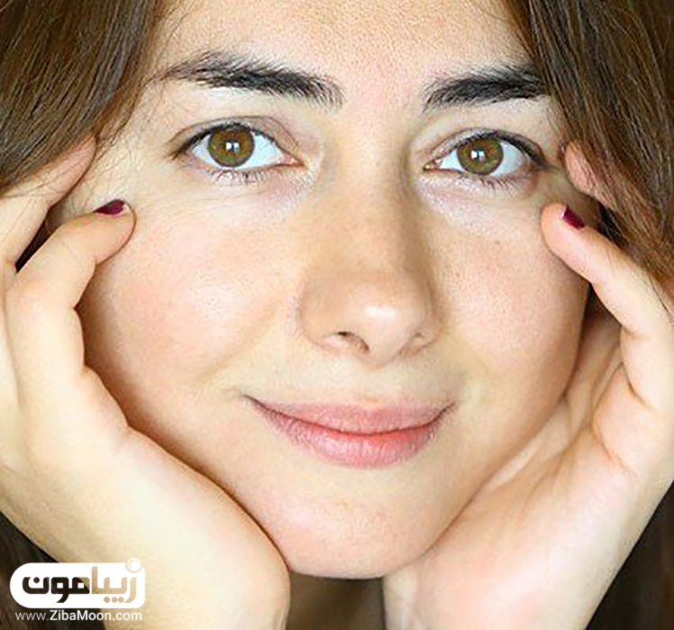 هانیه توسلی بدون آرایش - عمل زیبایی هانیه توسلی