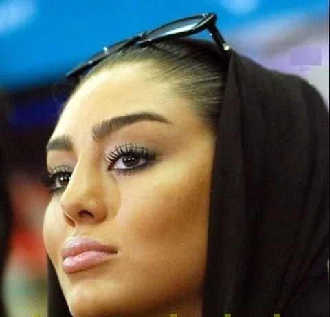 سحر قریشی با شال قهوه ای و عینک طبی - عمل زیبایی سحر قریشی