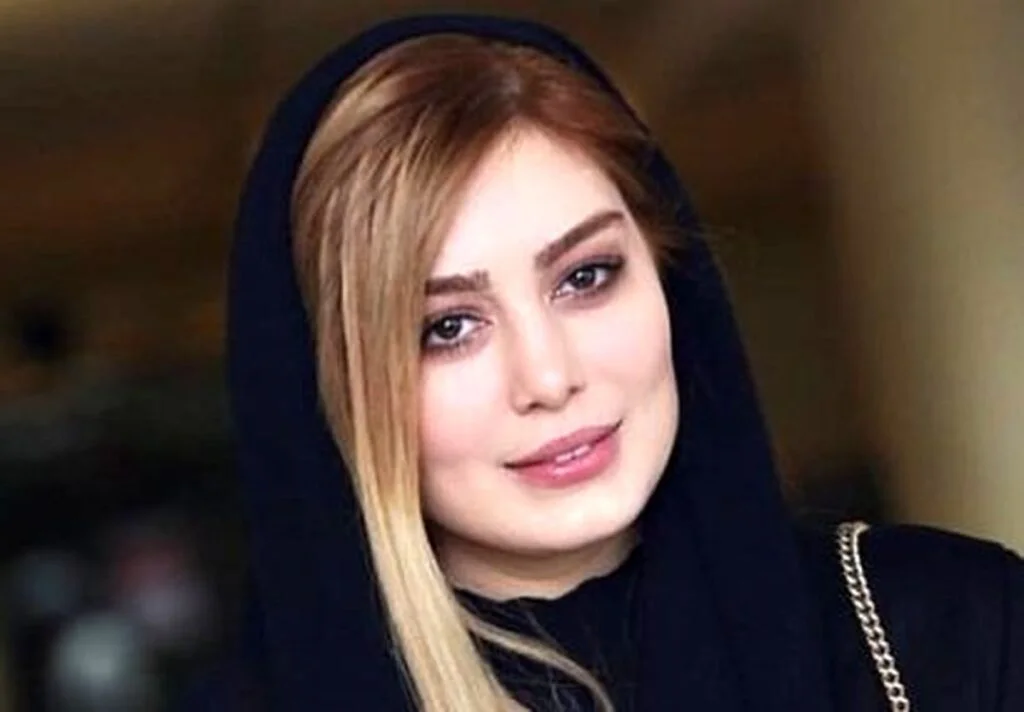سحر قریشی با شال مشکی - عمل زیبایی سحر قریشی