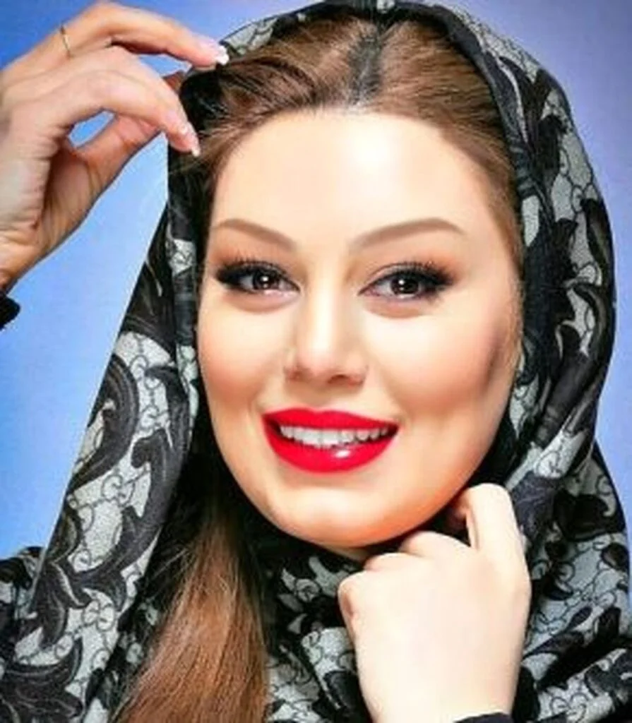 سحر قریشی با شال طرحدار - عمل زیبایی سحر قریشی