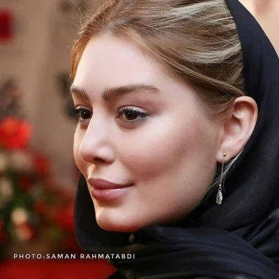 سحر قریشی با شال مشکی - عمل زیبایی سحر قریشی