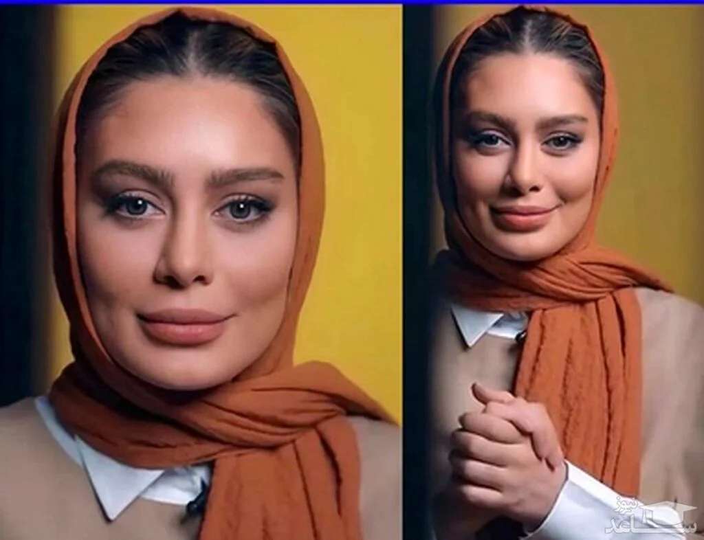 سحر قریشی با شال نارنجی - عمل زیبایی سحر قریشی
