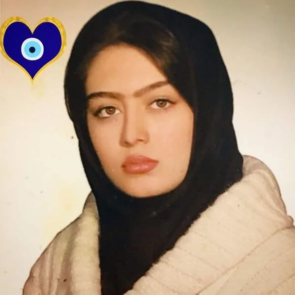 سحر قریشی قبل از عمل بینی