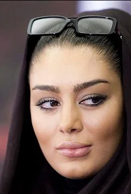 سحر قریشی با شال قهوه ای و عینک طبی - عمل زیبایی سحر قریشی