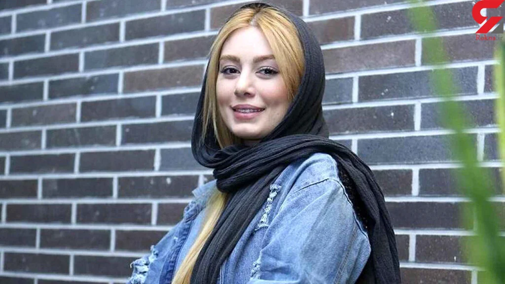 سحر قریشی با شال مشکی - عمل زیبایی سحر قریشی