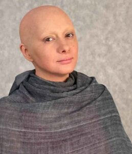 گریم هانیه توسلی با سر کچل شده