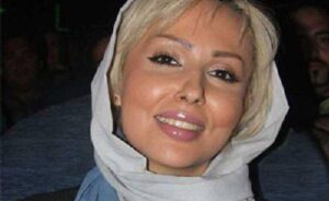 ژل لب پرستو صالحی