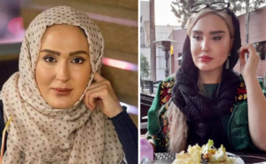 عکس قبل از عمل و بعد از عمل زهره فکورصبور