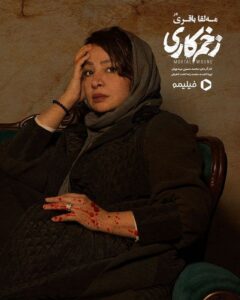 مه لقا باقری در زخم کاری