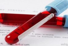 آزمایش خون MCV