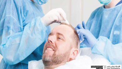 بهترین مرکز کاشت مو در تهران