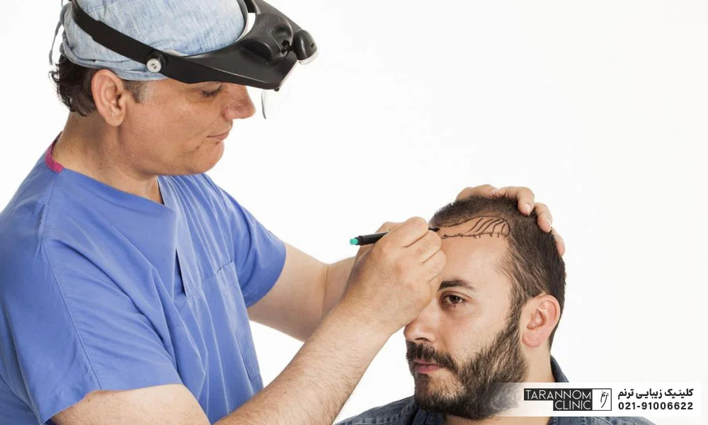 بهترین مرکز کاشت مو در تهران