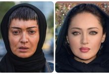 نیکی کریمی پس از عمل زیبایی