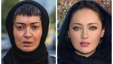 نیکی کریمی پس از عمل زیبایی
