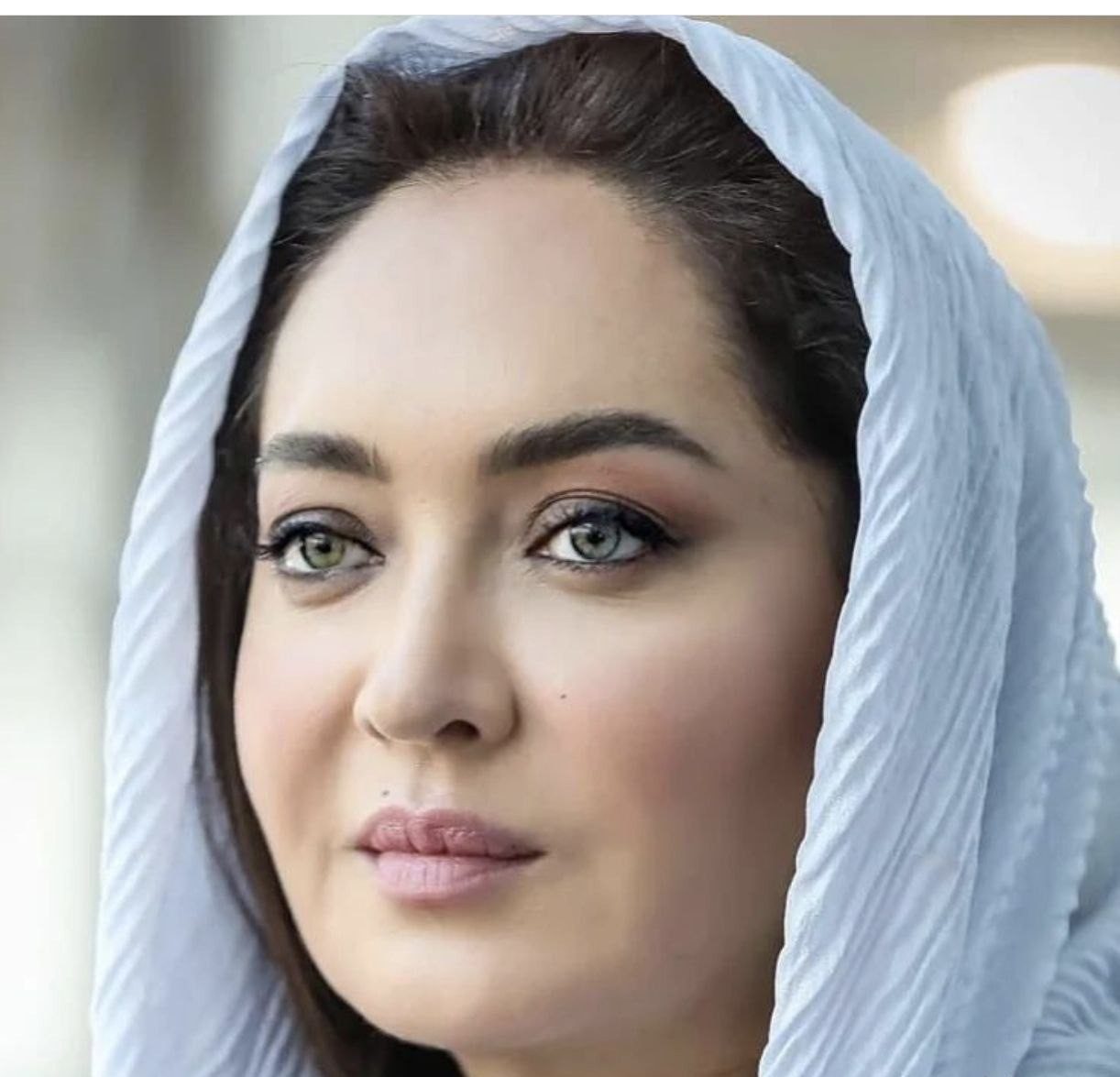 نیکی کریمی پس از عمل زیبایی