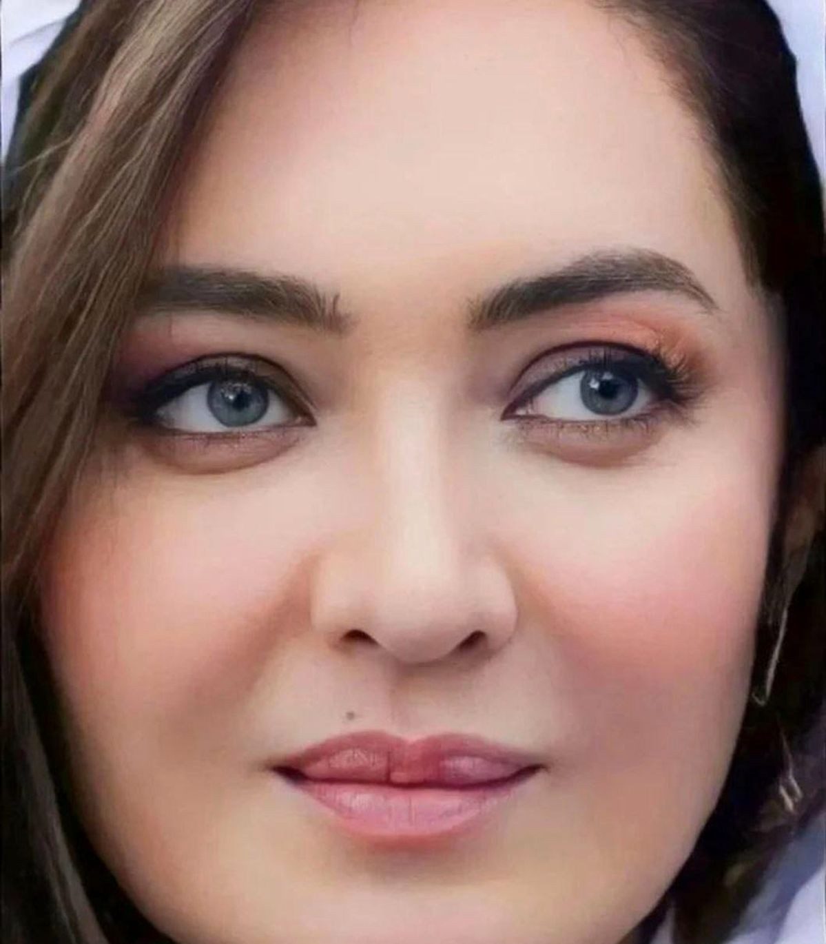 نیکی کریمی پس از عمل زیبایی