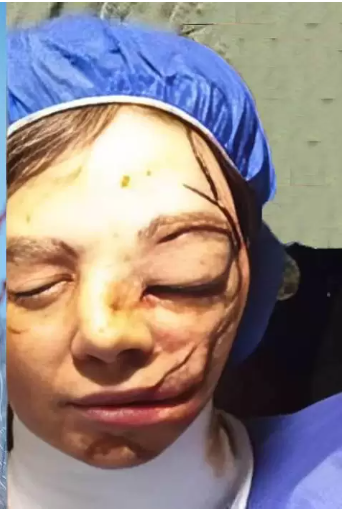 درگیری رعنا آزادی ور