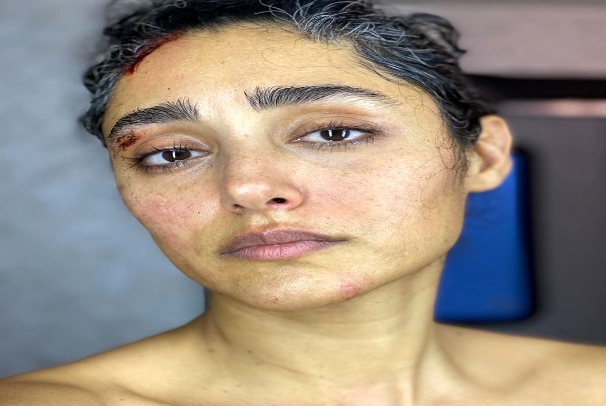 ماجرای اسید پاشی به گلشیفته فراهانی در خیابان چیست ؟