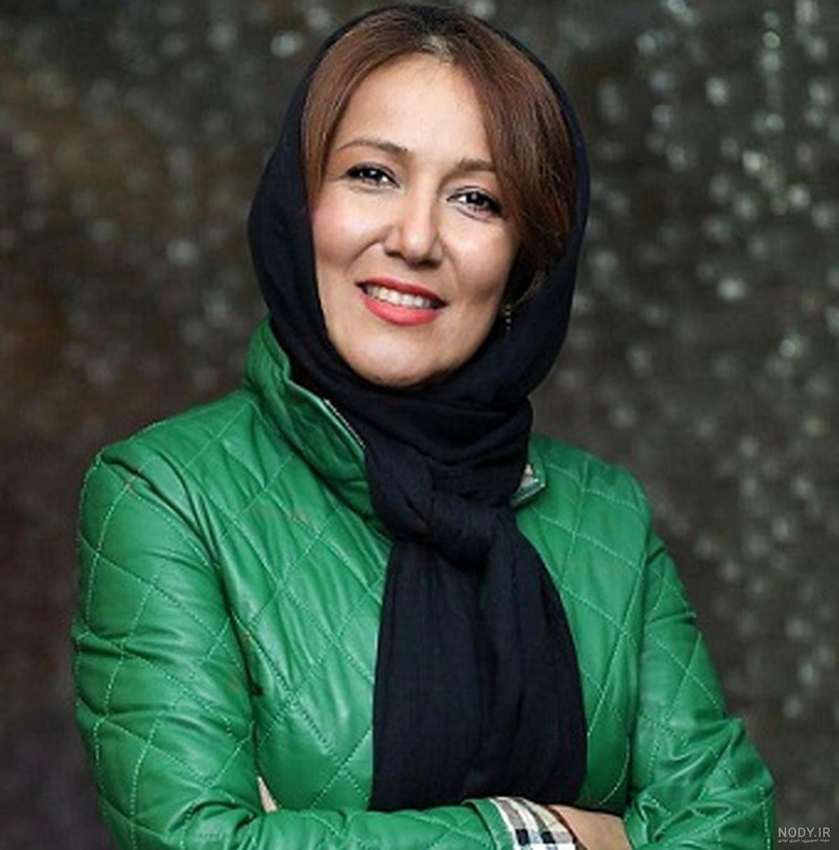 عمل زیبایی پانته آ بهرام