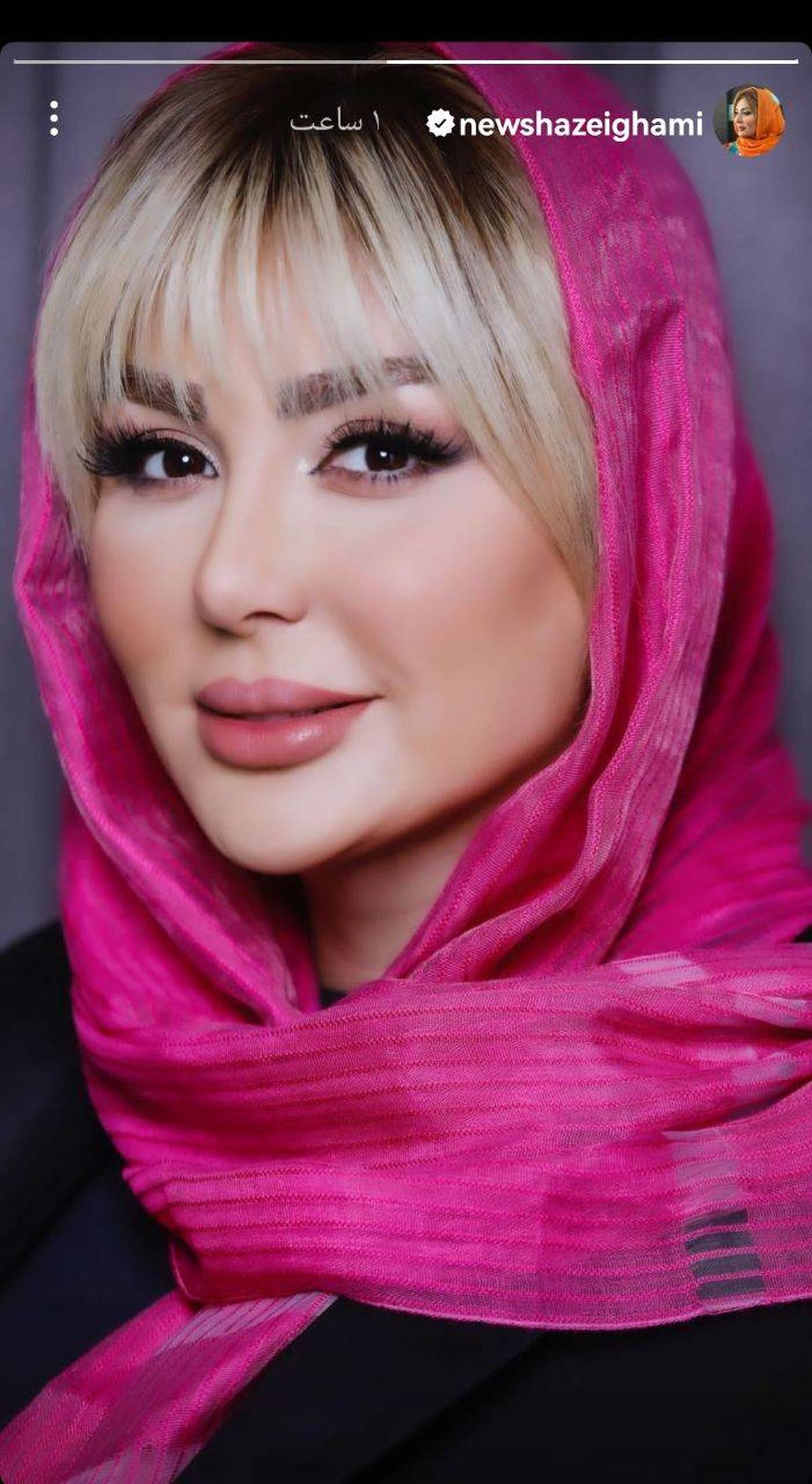 تغییر چهره نیوشا ضیغمی