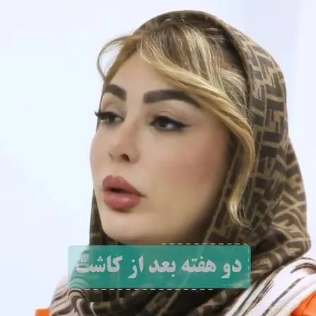 کاشت ابرو نیوشا ضیغمی