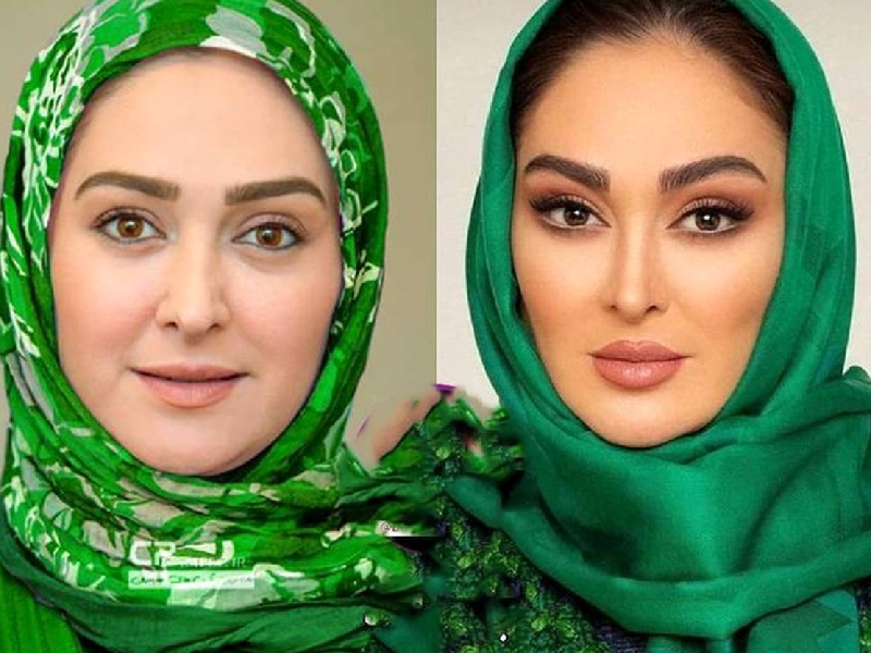 کاشت ابرو الهام حمیدی