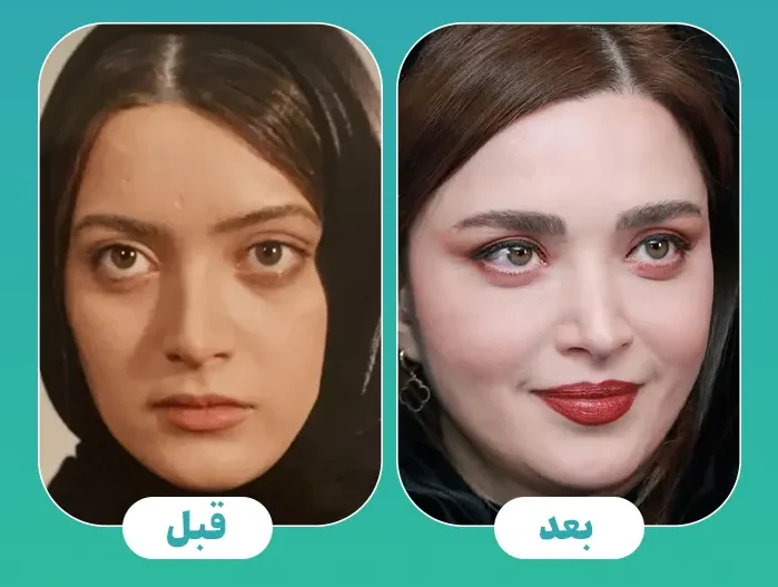 کاشت ابرو بهنوش طباطبایی